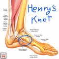 Master knot of henry
