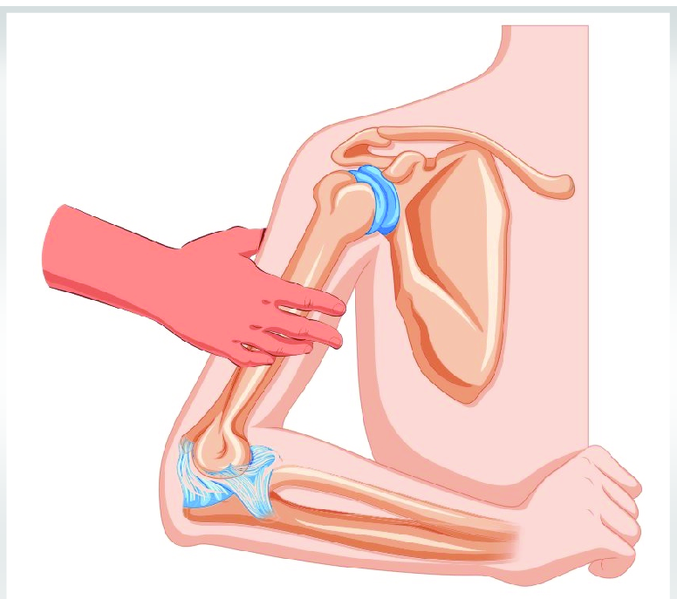 File:Arm squeeze test illustration.png