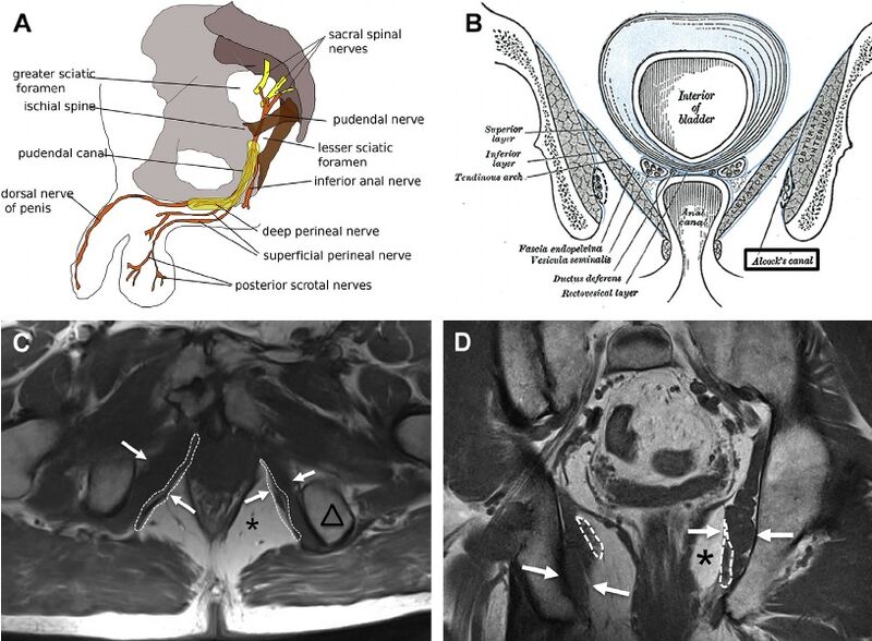File:Pudendal nerve anatomy.jpg