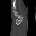 Thumbnail for version as of 17:43, 3 May 2025