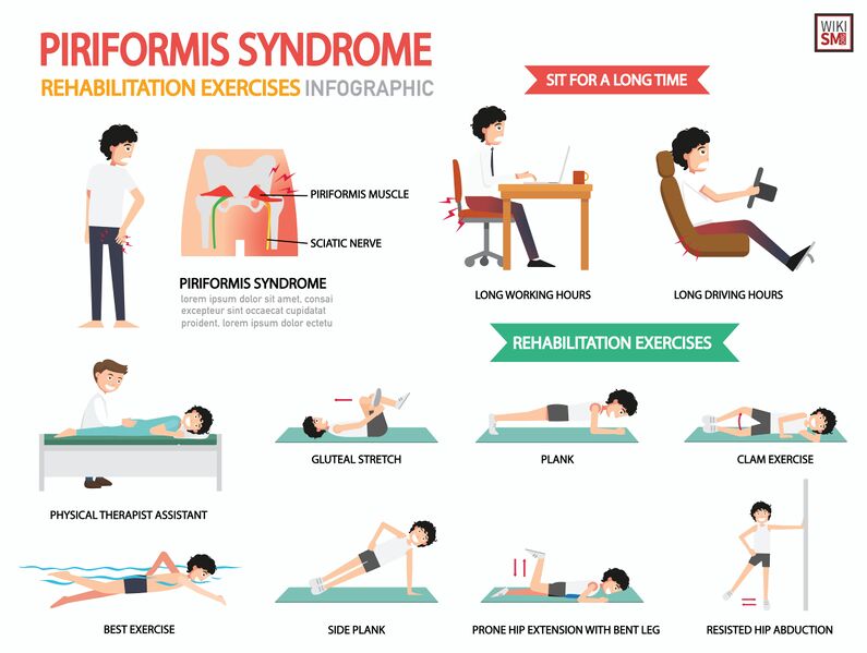 File:Piriformis syndrome exercises.jpeg