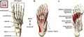 Illustrated anatomy of the foot A) The tarsal bones B) The plantar fascia C) The long plantar, short plantar and calcaneonavicular ligaments are located in the midfoot and are primarily longitudinally oriented. The deep and superficial transverse metatarsal ligaments are examples of stiff, transversally oriented elastic tissues between the metatarsals[2]