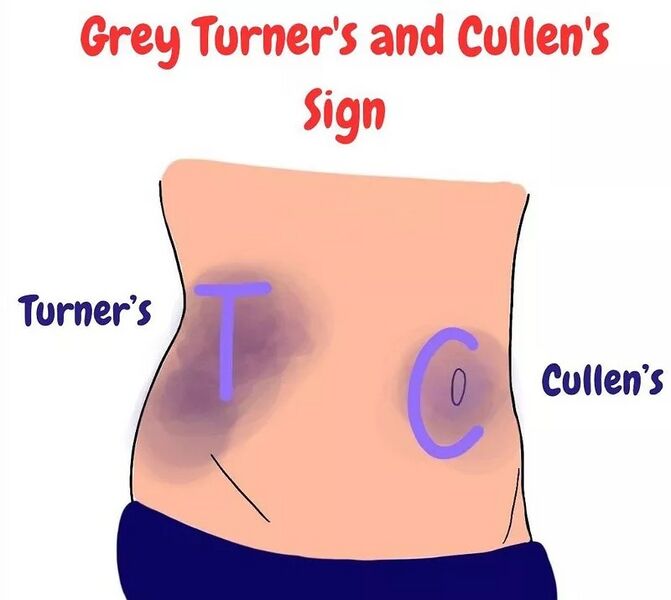 File:Grey turner cullen sign.jpeg