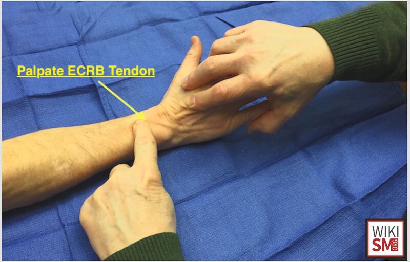 File:ECRB muscle test.jpeg