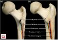 Observed attachments of psoas, iliacus, pectineus, adductor brevis and adductor magnus (a, posteromedial view; b, posterior view)[1]