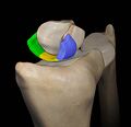 3D rendering of the SLL with the scaphoid removed to show the ligaments: dorsal (blue), proximal (yellow), volar (green) components[1]