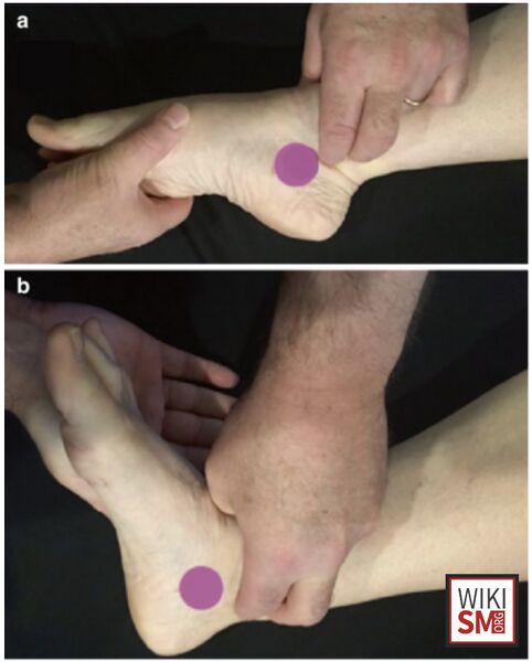File:Plantarflexion Inversion Test.jpeg