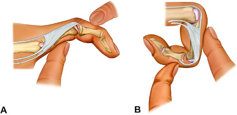 File:Finochietto test.jpg