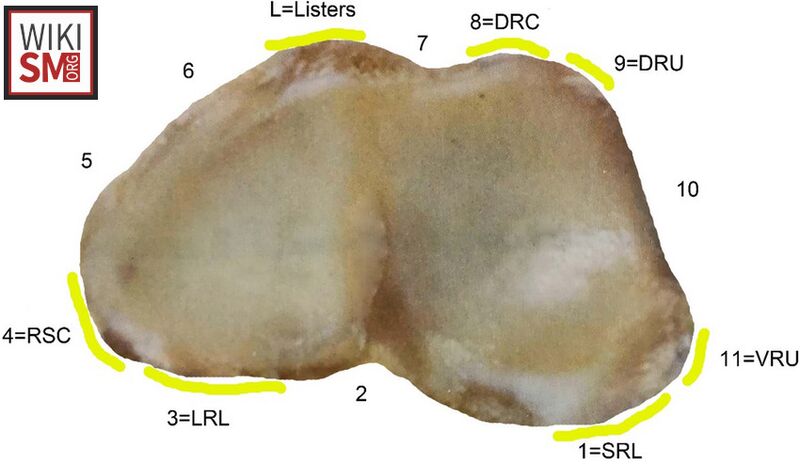 File:Radius ligament anatomy.jpeg