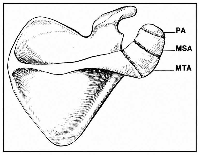 File:Os Acromiale classification.jpg