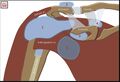 Bursa aorund the shoulder joint: 1. subacromial-subdeltoid bursa 2. Subscapularis bursa 3. Sucoracoid bursa 4. Coracoclavicular bursa 5. Supra-acromial bursa.
