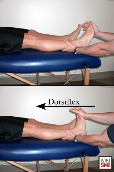 File:Homans sign DVT.jpeg