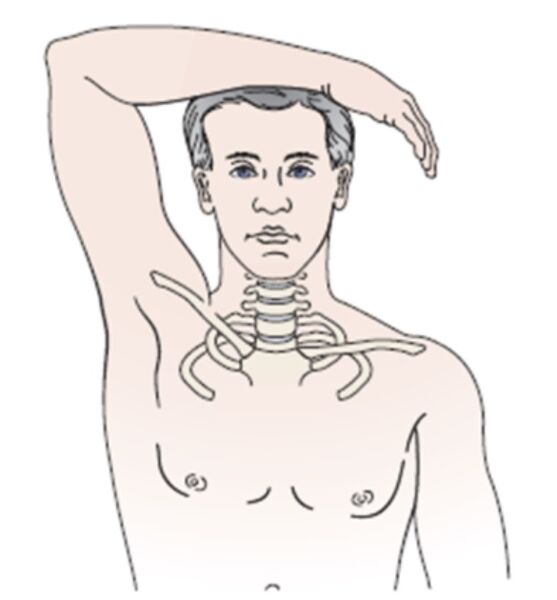 File:Bakody abduction relief test.jpg