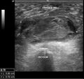 Thumbnail for version as of 15:58, 6 August 2024
