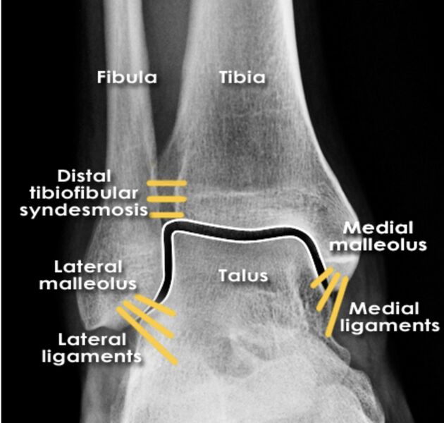 File:Ankle xray anatomy labeled.jpg