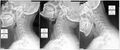 Thumbnail for version as of 16:54, 2 September 2025