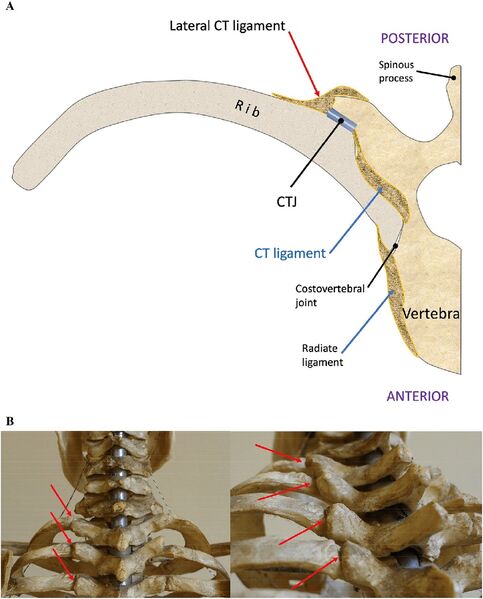 File:Costovertebral costotransverse Joints.jpg