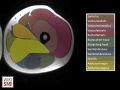 Cross sectional anatomy of the thigh[4]