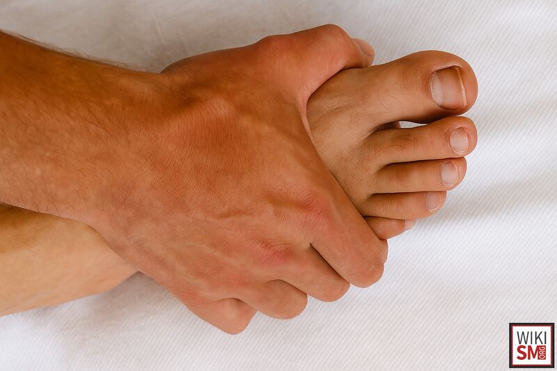 File:Midfoot squeeze test.jpeg
