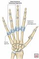 Deep transverse metacarpal ligaments
