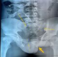 Thumbnail for version as of 00:34, 15 September 2025