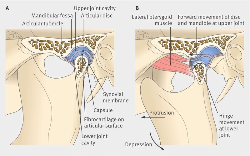 File:Temporomandibular Joint anatomy.jpg