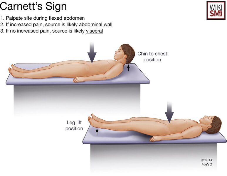 File:Carnetts sign.jpeg
