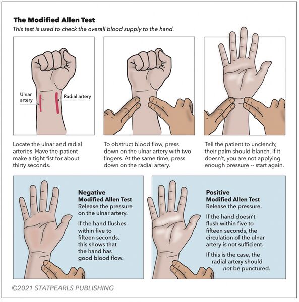 File:Modiefied allens test.jpg