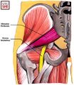 Schematic location of the sciatic nerve travelling below the piriformis muscle.[2]