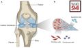 (A) Basic anatomy of the knee. (B) Cross-sectional diagram of the meniscus.[1]