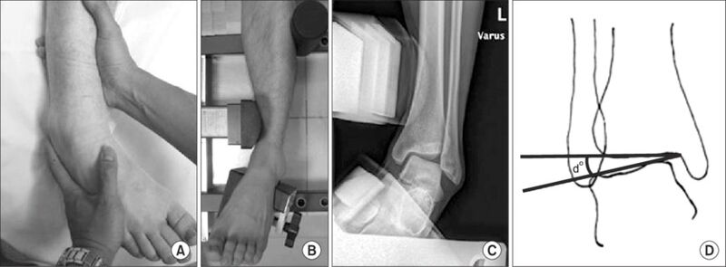 File:Inversion Stress Test.jpg